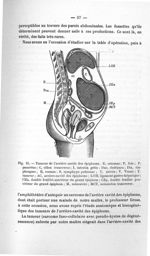 Fig. 15. Tumeur de l'arrière cavité des épiploons - Titres et travaux scientifiques
