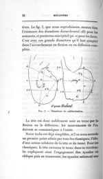 Fig. 3. Diamètre de solidarisation - Concours d'agrégation, chirurgie et accouchements, 1907. Exposé [...]