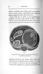 Fig. 4. Coupe montrant les rapports du tronc foetal avec le plan lombo-iliaque (Barbour) - Concours  [...]