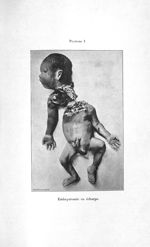 Embryotomie en écharpe - Concours d'agrégation, chirurgie et accouchements, 1907. Exposé des titres  [...]