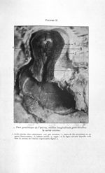 Face postérieure de l'utérus, section longitudinale pour montrer la cavité utérine - Concours d'agré [...]