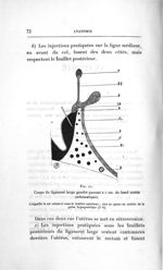 Fig. 11. Coupe du ligament large gauche passant à 1 cm. du bord utérin (schématique) - Concours d'ag [...]
