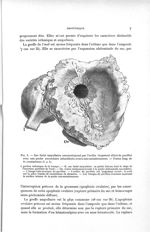 Fig. 2. Sac foetal ampullaire communiquant par l'orifice largement dilaté du pavillon avec une poche [...]