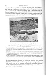 Fig. 9. Grossesse ampullaire - Titres et travaux scientifiques