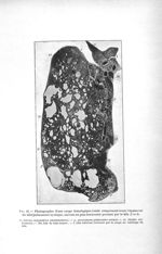 Fig. 42. Photographie d'une coupe histologique totale comprenant toute l'épaisseur du lobe pulmonair [...]