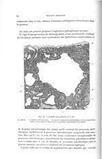 Fig. 44. Lobule sous-pleural - Titres et travaux scientifiques
