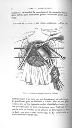Fig. 3. Section sus-vaginale du col de l'utérus - Titres et travaux scientifiques
