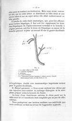 Fig. 4. a l d, artère allant au lobe droit ; a h, branches hépatiques ; p, pylorique ; g d, gastro-d [...]