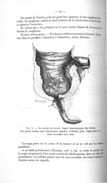 Fig. 5. Le caecum est ouvert - Avril 1907. Titres et travaux scientifiques
