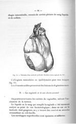Fig. 11. Volvulus d'un testicule pédicule - Titres et travaux scientifiques