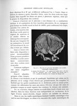 Fig. 65. Placenta de grossesse bivitelline avec cavités amniotiques communicantes - Exposé des titre [...]