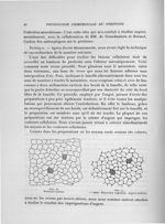 Fig. 16. Péritoine normal / Fig. 17. 1er stade : Rétraction angulaire. Aspect stellaire - Exposé des [...]