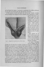 Fig. 2. Rapports de la prostate avec le col de la vessie - Exposé des travaux scientifiques