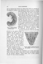 Fig. 21. Néphrite rayonnante expérimentale déterminée par le colibacille (lapin) / Fig. 22. Ascensio [...]