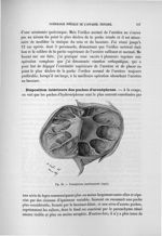 Fig. 30. Uronéphrose expérimentale (lapin) - Exposé des travaux scientifiques