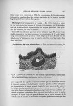 Fig. 34. Prolifération de l'épithélium de la vessie qui prend le type allantoïdien - Exposé des trav [...]