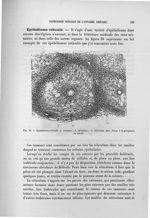 Fig. 36. Epithélioma réticulé - Exposé des travaux scientifiques