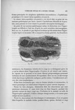 Fig. 45. Lobules d'épithélioma adénoïde - Exposé des travaux scientifiques