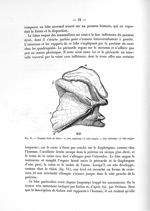 Fig. 11. Poumon droit de chien : a, lobe supérieur ; b, lobe moyen ; c, lobe inférieur ; d, lobe azy [...]