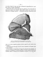 Fig. 12. Poumon droit d'un homme présentant un lobus impar - Notice sur les travaux scientifiques