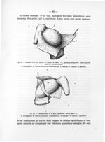 Fig. 25. Testicule et corne gauche de l'utérus de Marie C..., pseudo-hermaphrodite (andro-gynoïde ré [...]