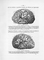 Fig. 29. Hémisphère cérébral droit / Fig. 30. Hémisphère cérébral gauche - Notice sur les travaux sc [...]
