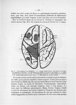 Fig. 41. Face supérieure des hémisphères - Notice sur les travaux scientifiques