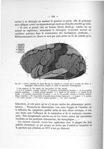 Fig. 42. Calotte crânienne de Jenny (50 ans), sur laquelle on a dessiné, par le procédé des fiches,  [...]