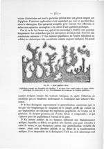 Fig. 65. Kyste papillaire bénin - Notice sur les travaux scientifiques