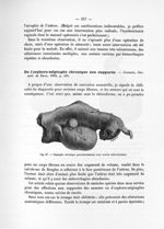 Fig. 67. Salpingite chronique parenchymateuse avec ovarite scléro-kystique - Notice sur les travaux  [...]