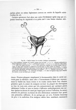 Fig. 84. Section conique du col utérin - Notice sur les travaux scientifiques