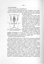 Fig. 91. Création d'un vagin par autoplastie cutanée - Notice sur les travaux scientifiques
