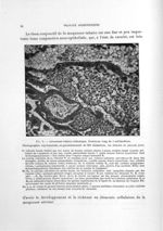 Fig. 5. Grossesse tubaire isthmique - Titres et travaux scientifiques
