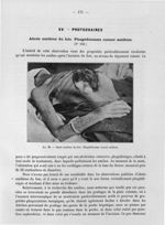 Fig. 98. Abcès amibien du foie - Titres et travaux scientifiques avec deux suppléments, 1911-1914 et [...]