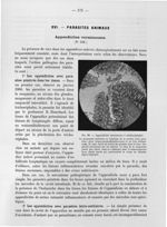Fig. 99. Appendicite vermineuse à trichocéphales - Titres et travaux scientifiques avec deux supplém [...]