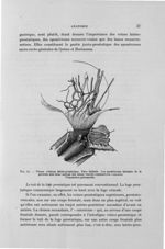 Fig. 13. Plexus veineux latéro-prostatique. Face latérale - Titres et travaux scientifiques