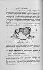 Fig. 32. Coupe frontale au niveau de la selle turcique - Titres et travaux scientifiques