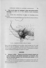 Fig. 52. Diverticule de la grande courbure de l'estomac - Titres et travaux scientifiques