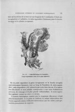 Fig. 55. Coupe histologique de l'appendice - Titres et travaux scientifiques