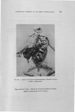 Fig. 68. Autre cas de hernie diaphragmatique (Eynard et Küss) variété : embryonnaire - Titres et tra [...]