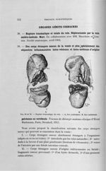 Fig. 69 et 70. Rupture traumatique du rein - Titres et travaux scientifiques
