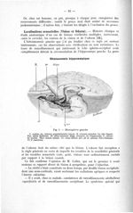 Fig. 1. Hémisphère gauche - Exposé des titres et des travaux scientifiques. Mai 1920