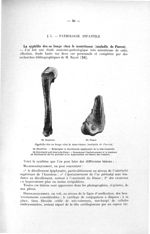 Syphilis des os longs chez le nourrisson (maladie de Parrot) - Exposé des titres et des travaux scie [...]