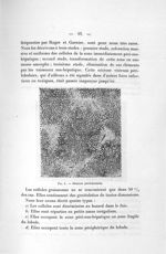 Fig. 1. Stéatose périlobulaire - Titres et travaux scientifiques du Dr. René Bénard : mai 1913, avec [...]
