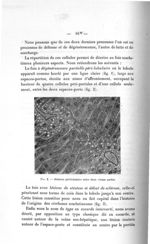 Fig. 2. Stéatose périlobulaire entre deux veines portes - Titres et travaux scientifiques du Dr. Ren [...]