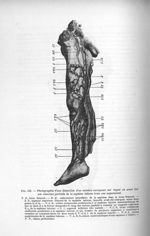 Fig. 159. Photographie d'une dissection d'un membre variqueux sur lequel on avait fait une résection [...]