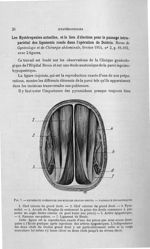 Fig. 7. Extrémité inférieure des muscles grands droits. - Vaisseaux épigastriques - Titres et travau [...]