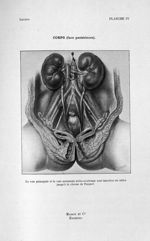 Corps (face postérieure). La voie principale et la voie accessoire utéro-ovarienne sont injectées en [...]