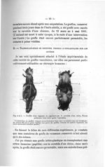 Fig. 4 et 5. Greffes d'un segment de jugulaire sur la carotide d'un chien. Pièces prélevées trois mo [...]