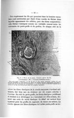 Fig. 9. Étude de la suture. Réaction autour des fils - Titres et travaux scientifiques